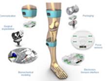 smart-implants-for-orthopaedics-surgery