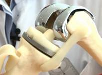 smart-implants-for-orthopaedics-surgery