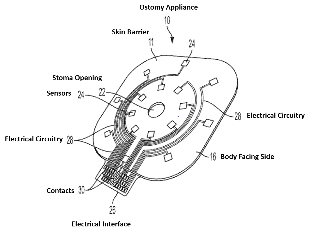 Ostomy-appliance-with-sensor