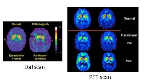 scan-of-brain
