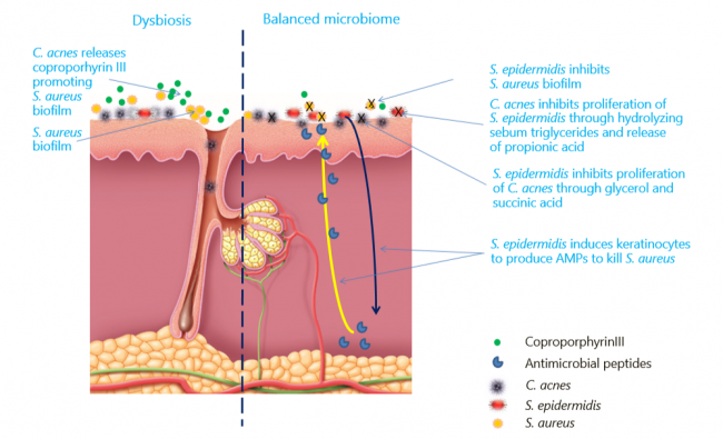 acnes-and-skin-microbiome-association