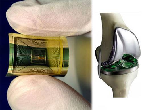 Smart Implants in Orthopaedics