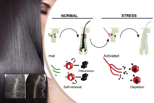 Reversal of Grey Hair - Scitech Patent Art